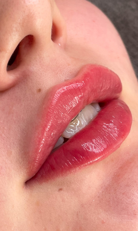 Näyttävät huulet täyteaineella Tampere