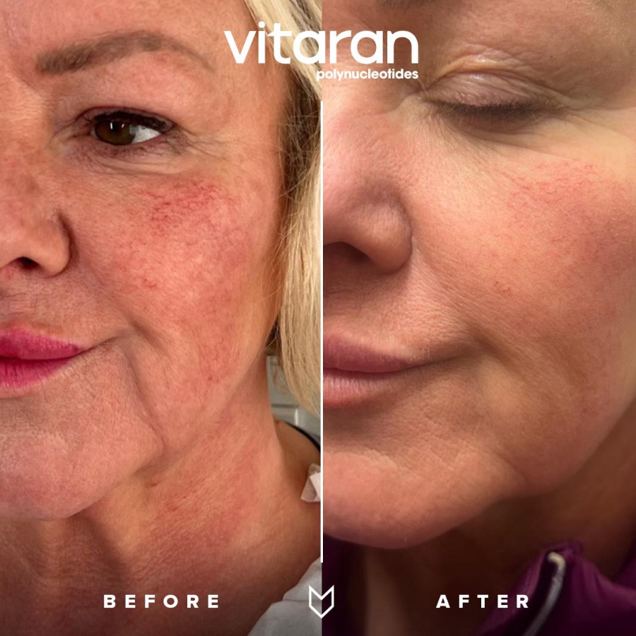 Vitaran ihonhoito Tampere