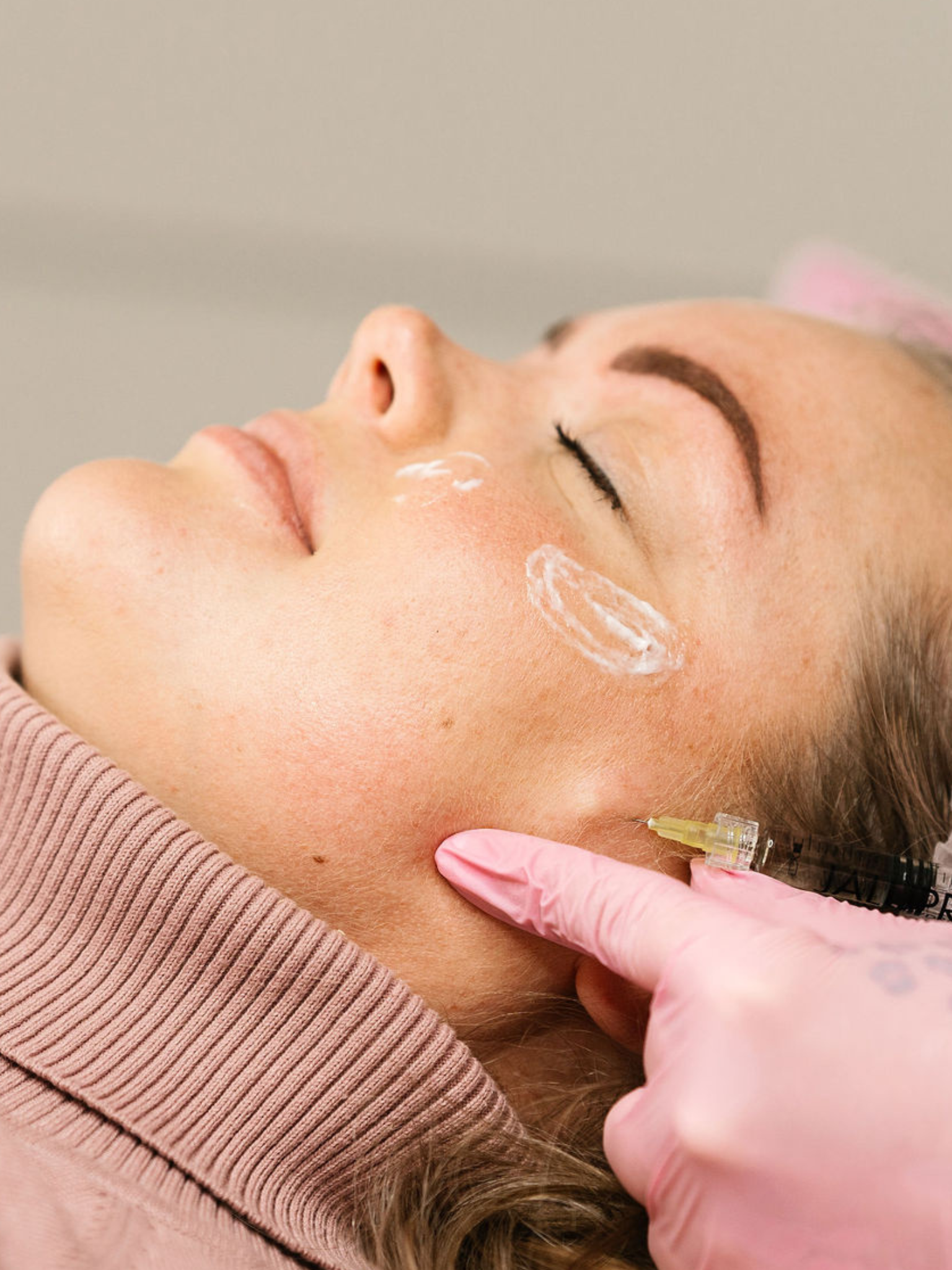 Full Face täyteainehoito | Esteettinen sairaanhoitaja Tampere