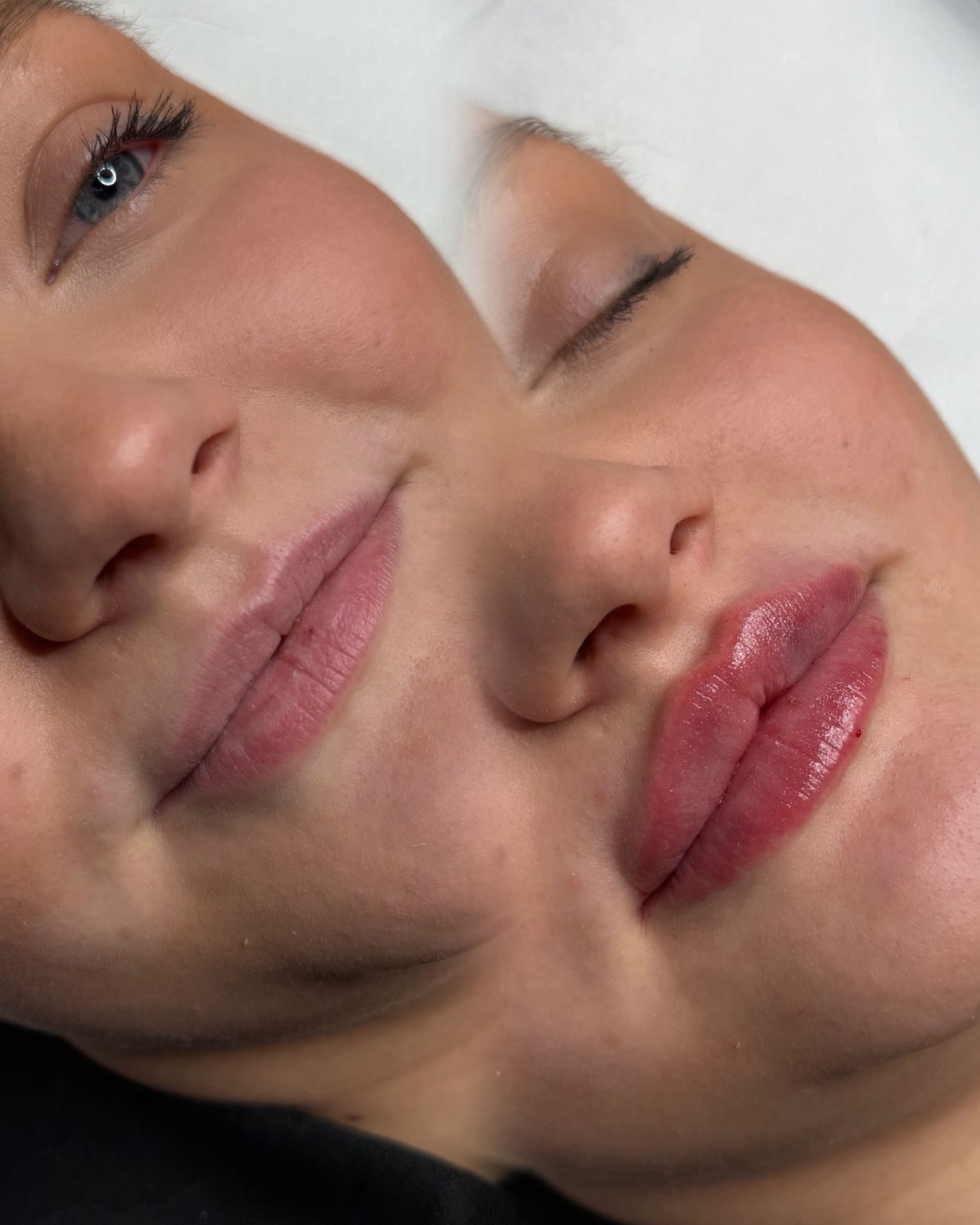 Näyttävät huulet täyteaineella Tampere