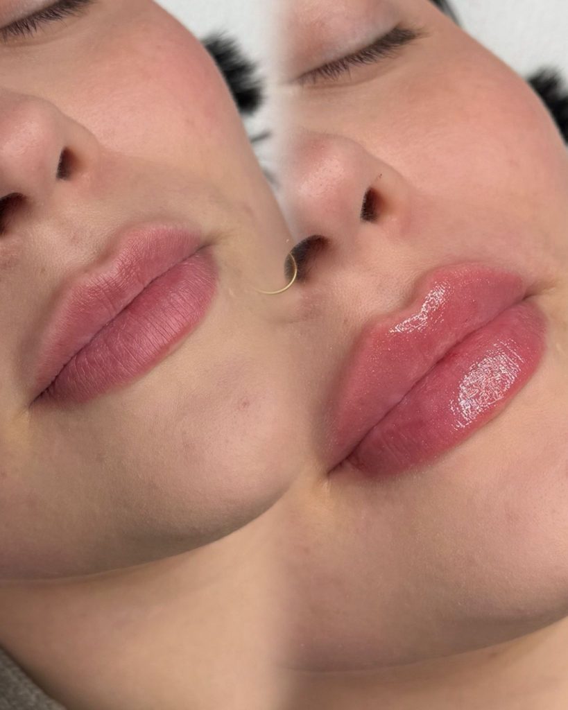 Täyteläiset huulet Tampere Jutta Salenius